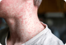 Warning symptoms image